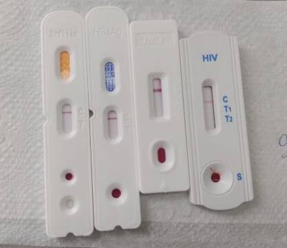 Testes de HIV